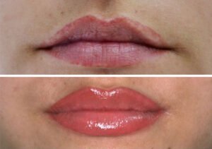 micropigmentacion labios